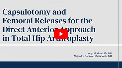 Direct Anterior Hip Replacement: Capsulotomy & Femoral Releases Technique | Dr. Gonzalez Della Valle