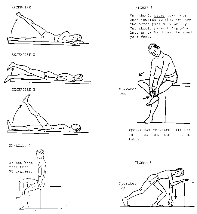 INSTRUCTIONS TO PREVENT DISLOCATIONS