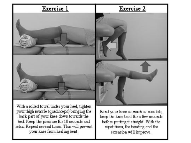 Instructions to Prevent / Treat Early Limited Mobility of Your Knee Replacement