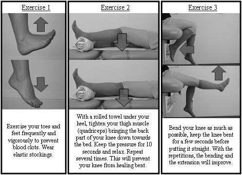 How To Sit After Hip Replacement Surgery  Doctor's Sitting Guide Hip Joint  Instructions