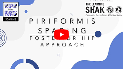 Piriformis-Sparing Posterior Hip Approach Explained