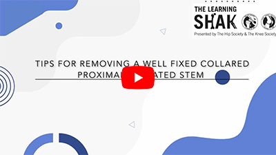 Removing a Well-Fixed Femoral Stem: Surgical Tips