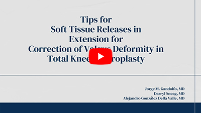 Valgus Knee Replacement: Soft Tissue Releases in Extension | Total Knee Arthroplasty Technique